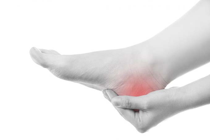 How To Get Rid Of Plantar Fasciitis: Techniques + Products